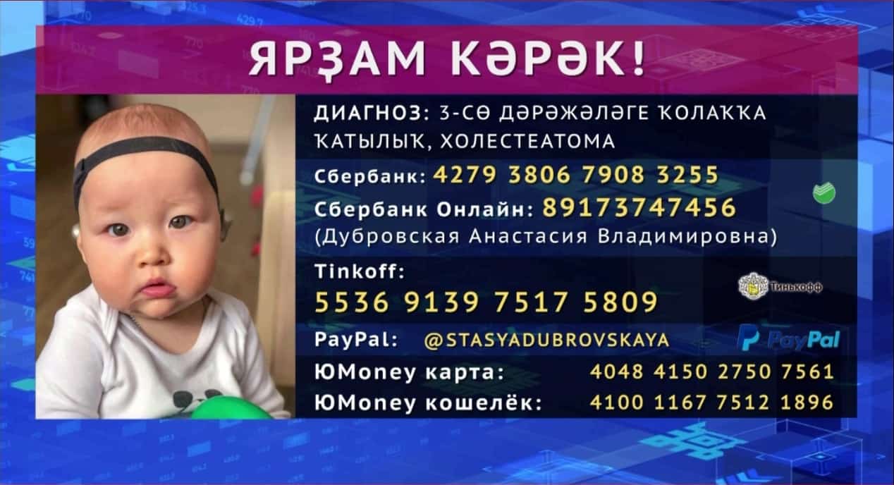 Һирәк осрай торған патология...