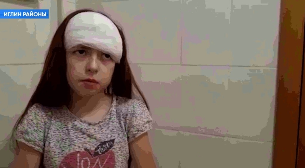 Иглин районының Таутөмән ауылында ун йәшлек ҡыҙҙы эт талаған